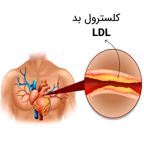 کاهش کلسترول بد خون با داروی ازتیمایب و رزوواستاتین