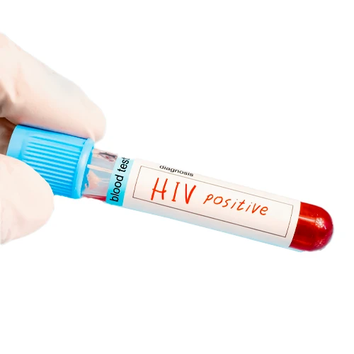 بیماری اچ ای وی از موارد احتیاطی دریافت واکسن گارداسیل
