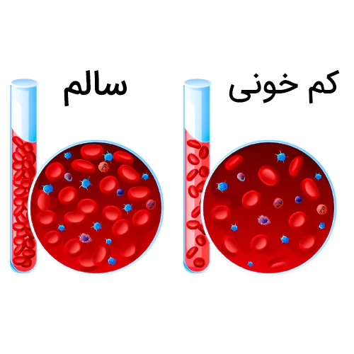 داروی راوولیزوماب موثر در درمان نوعی بیماری خونی 