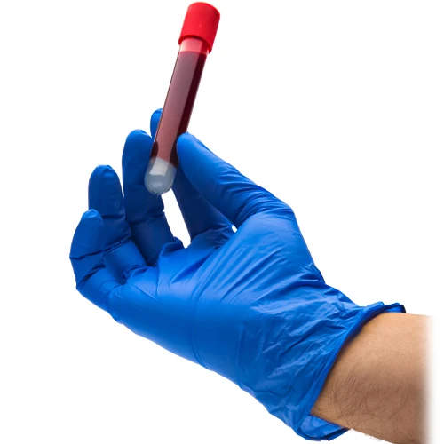 آزمایش خون از راه های تشخیص گرگرفتگی