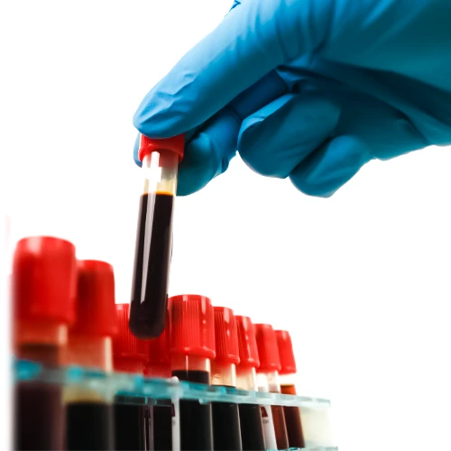 آزمایش خون از راه های تشخیص منوراژی