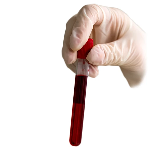 آزمایش خون از روش های تشخیص ابتلا به هرپس تناسلی