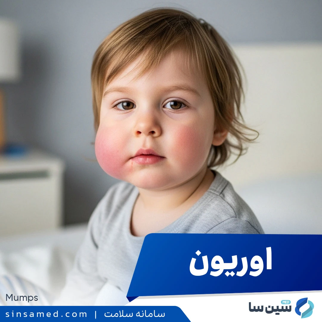 بیماری اوریون