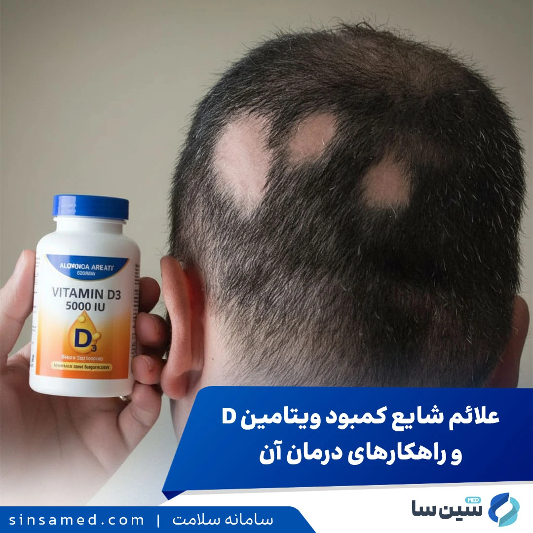 علائم شایع کمبود ویتامین D و راهکارهای درمان آن