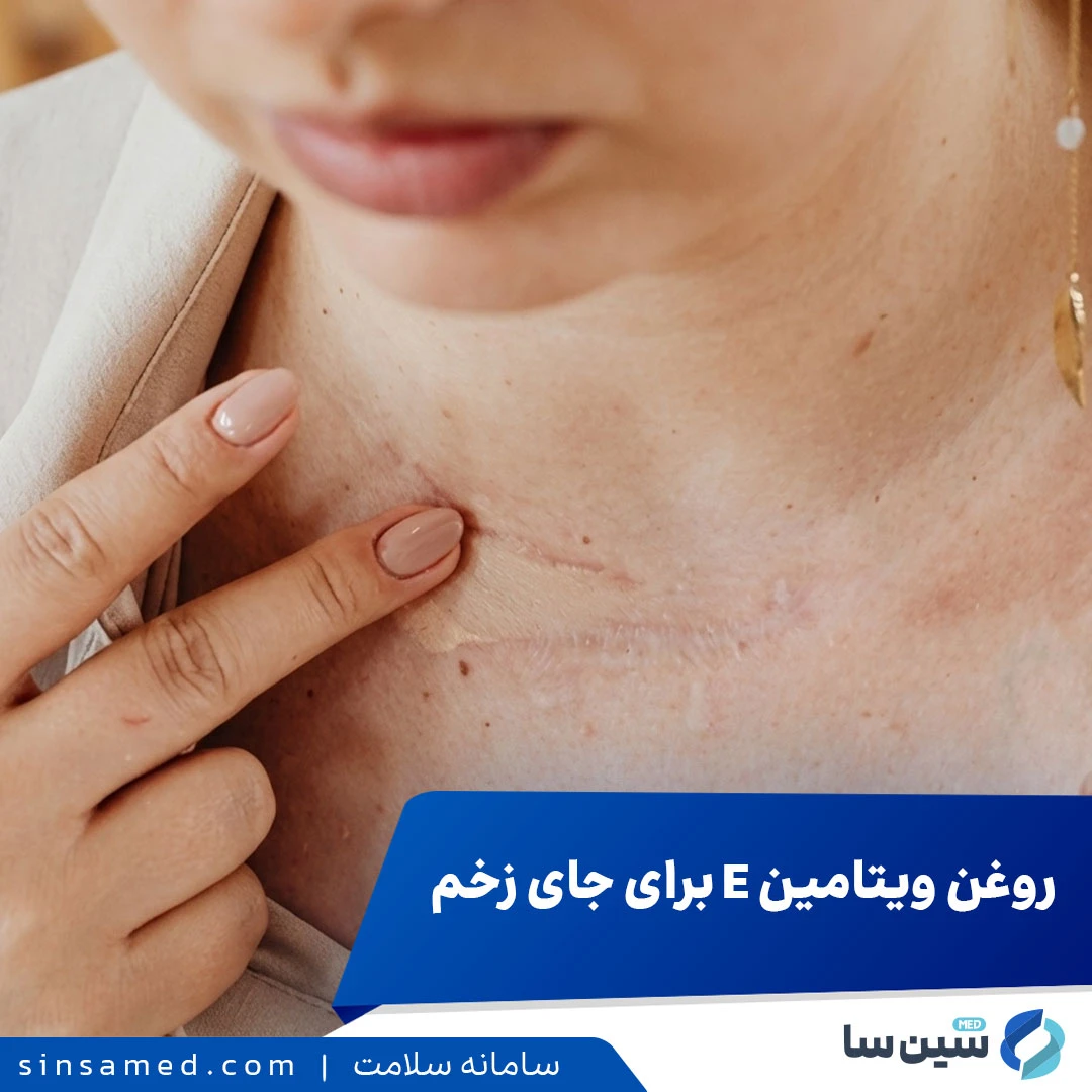 روغن ویتامین E برای جای زخم (اسکار)؛ آیا واقعاً مؤثر است؟