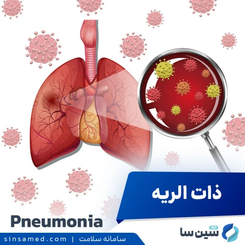 ذات الریه (پنومونی) | علل بروز، نشانه ها، روش تشخیص و درمان