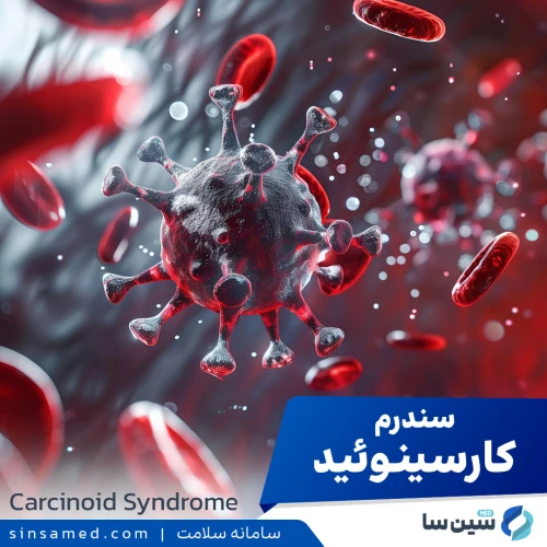 سندرم کارسینوئید | علل بروز، نشانه ها، روش تشخیص و درمان آن