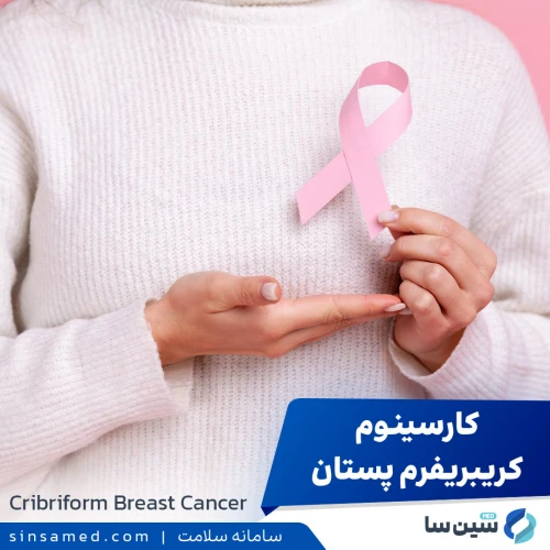 سرطان کریبریفرم پستان | علل بروز، نشانه ها، تشخیص و درمان آن