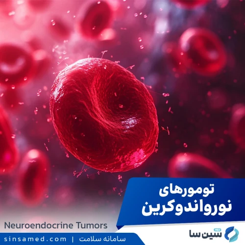 علت ایجاد تومورهای نورواندوکرین، نحوه تشخیص و درمان آن