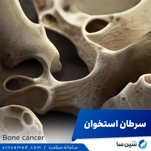 سرطان استخوان | علل بروز، نشانه ها، روش تشخیص و درمان آن