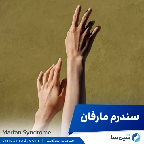 سندرم مارفان | علل بروز، نشانه ها، روش تشخیص و درمان آن
