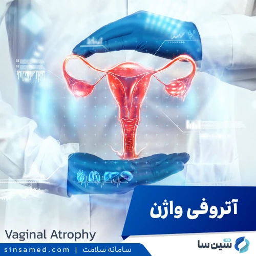آتروفی واژن یا سندرم ادراری تناسلی یائسگی چیست؟