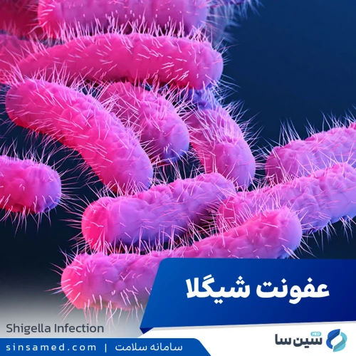 عفونت ناشی از شیگلا | علل بروز، نشانه ها، تشخیص و درمان