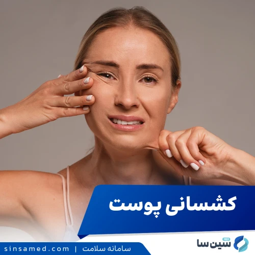 خاصیت ارتجاعی پوست چیست و 12 روش برای بهبود آن