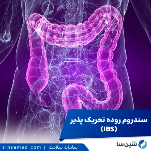 سندرم روده تحریک پذیر | علل بروز، نشانه ها، تشخیص و درمان