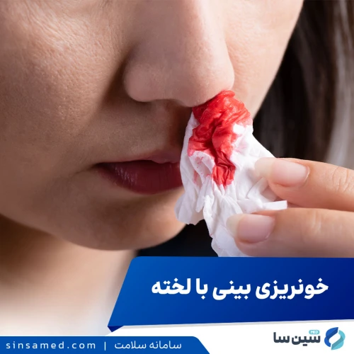 خونریزی بینی با لخته | علل بروز، پیشگیری و درمان