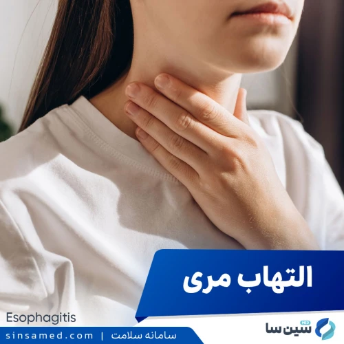 ازوفاژیت (التهاب مری) | علل بروز، نشانه ها، تشخیص و درمان