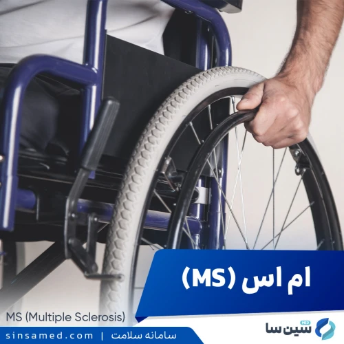 ام اس (MS) | علل بروز، نشانه ها، روش تشخیص و درمان
