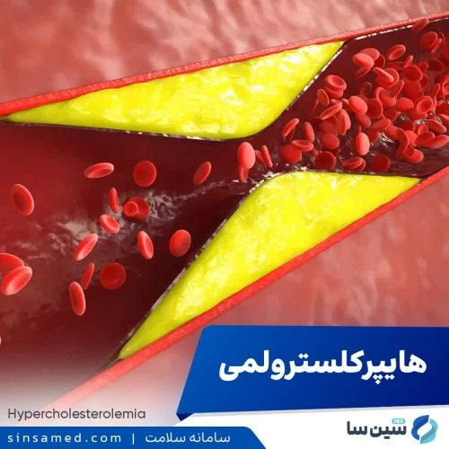 کلسترول بالای خون | علل بروز، نشانه ها، روش تشخیص و درمان