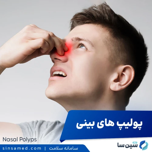 پولیپ های بینی | علل بروز، نشانه ها، روش تشخیص و درمان