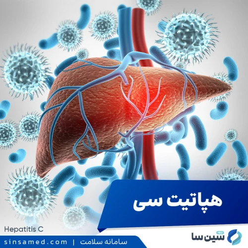 هپاتیت سی | علل بروز، نشانه ها، روش تشخیص و درمان