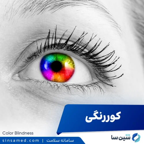کوررنگی | علل بروز، نشانه ها، روش تشخیص و درمان