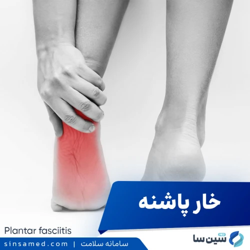 خار پاشنه | علل بروز، نشانه ها، روش تشخیص و درمان