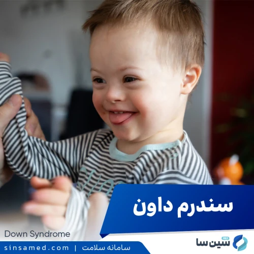 سندرم داون | علل بروز، نشانه ها و تشخیص