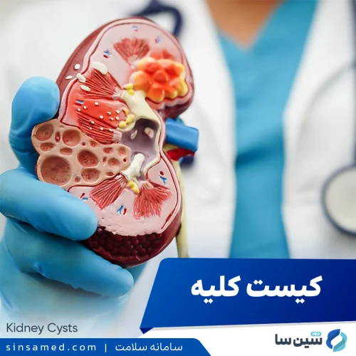 کیست کلیه | علل بروز، نشانه ها، روش تشخیص و درمان