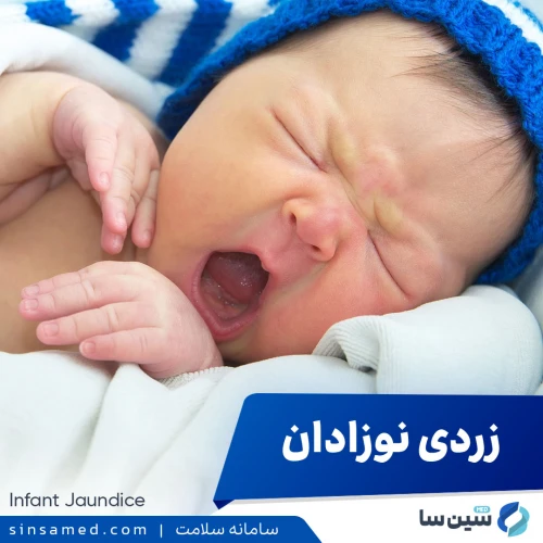 زردی نوزادان | علل بروز، نشانه ها، روش تشخیص و درمان