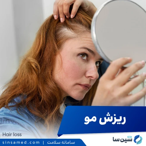 ریزش مو (آلوپسی) | علل بروز، نشانه ها، روش تشخیص و درمان