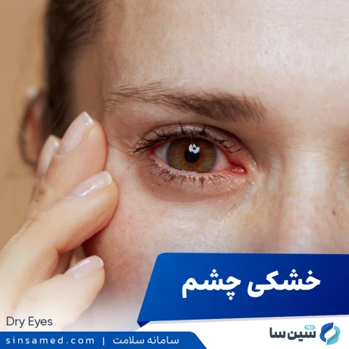 خشکی چشم | علل بروز، نشانه ها، روش تشخیص و درمان