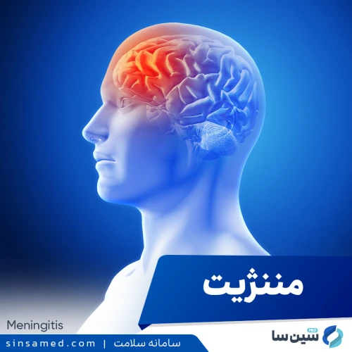 مننژیت | علل بروز، نشانه ها، روش تشخیص و درمان