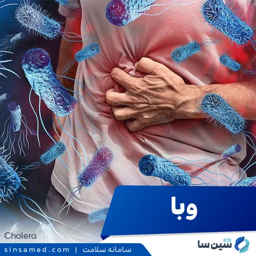 بیماری وبا | علل بروز، نشانه ها، روش تشخیص و درمان