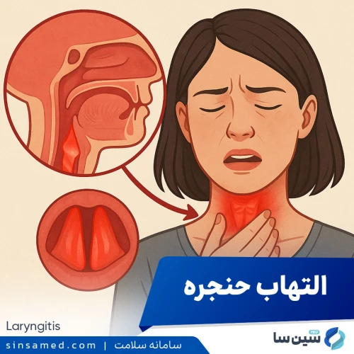 التهاب حنجره (لارنژیت) | علل بروز، نشانه ها، تشخیص و درمان