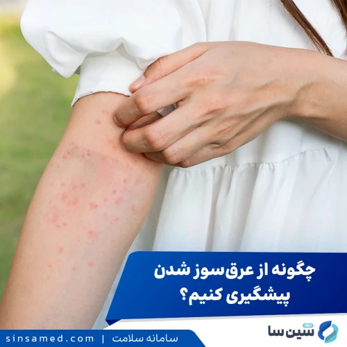 پیشگیری از عرق سوز شدن در فصل های گرم سال و درمان آن