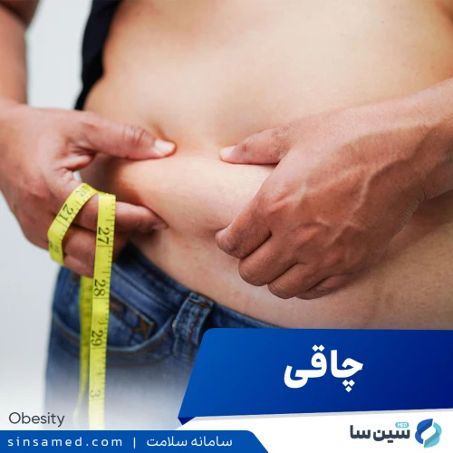 بیماری چاقی | علل بروز، نشانه ها، روش تشخیص و درمان