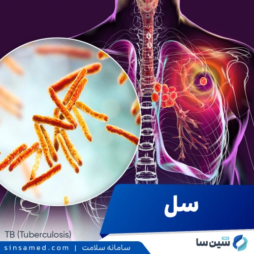 بیماری سل | علل بروز، نشانه ها، روش تشخیص و درمان