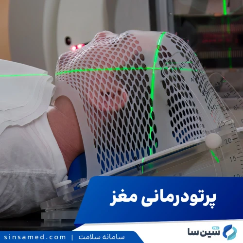 رادیوتراپی مغز چرا و چگونه انجام می‌شود؟ عوارض آن چیست؟