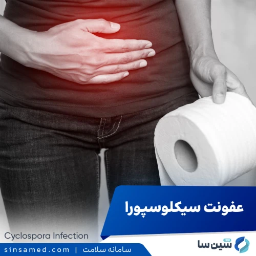 عفونت سیکلوسپورا (سیکلوسپوریازیس) | علل بروز، تشخیص و درمان