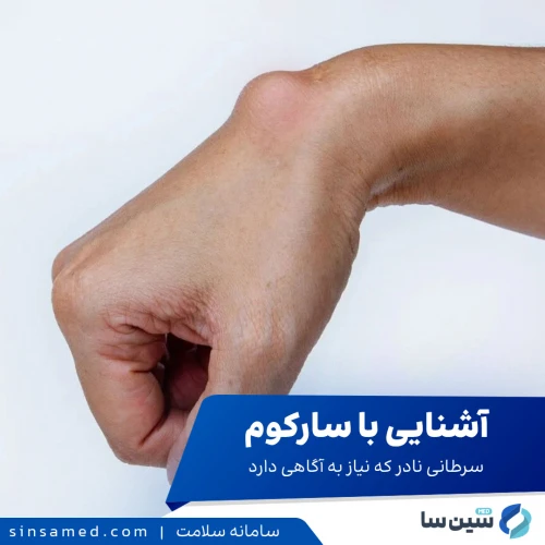 آشنایی با سارکوم | سرطانی نادر که باید بهتر بشناسید