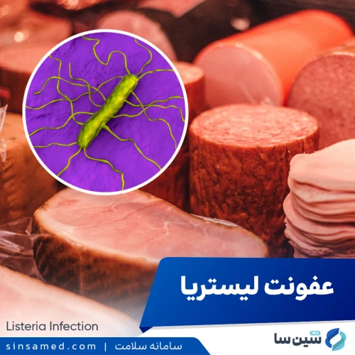 عفونت لیستریا (لیستریوز) | علل بروز، روش تشخیص و درمان