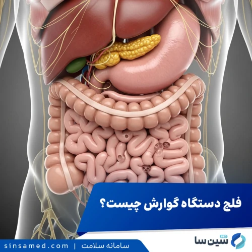 فلج دستگاه گوارش چیست؟ از تشخیص تا درمان‌های پیشرفته