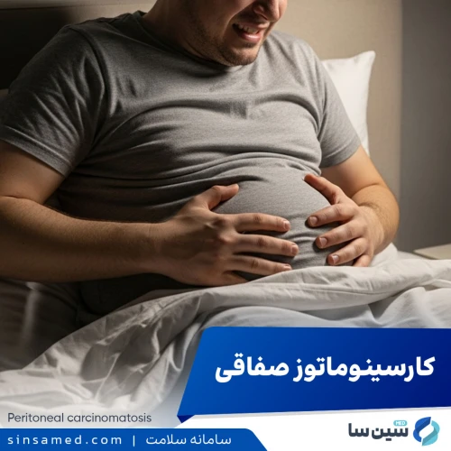 کارسینوماتوز صفاقی | علل بروز، نشانه ها، روش تشخیص و درمان