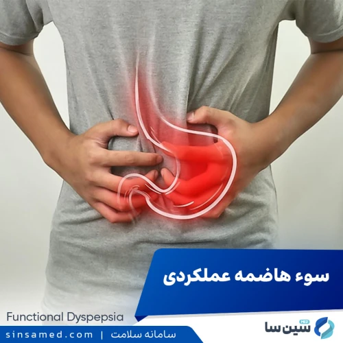 سوءهاضمه عملکردی | علل بروز، نشانه ها، روش تشخیص و درمان