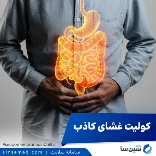 کولیت غشای کاذب | علل بروز، نشانه ها، تشخیص و درمان