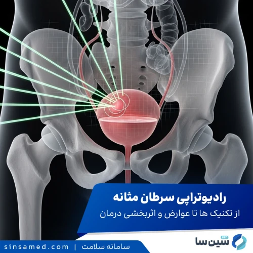 رادیوتراپی سرطان مثانه | از عوارض جانبی تا اثربخشی درمان