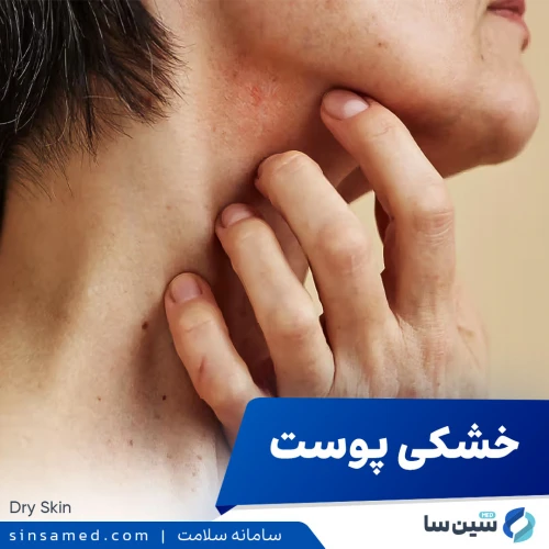 خشکی پوست | علل بروز، نشانه ها، روش تشخیص و درمان