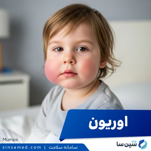 بیماری اوریون | علل بروز، نشانه ها، روش تشخیص و درمان