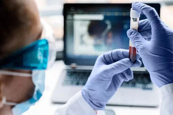 آزمایش خون جدید با دقت 96%، راهی برای تشخیص سندرم خستگی مزمن